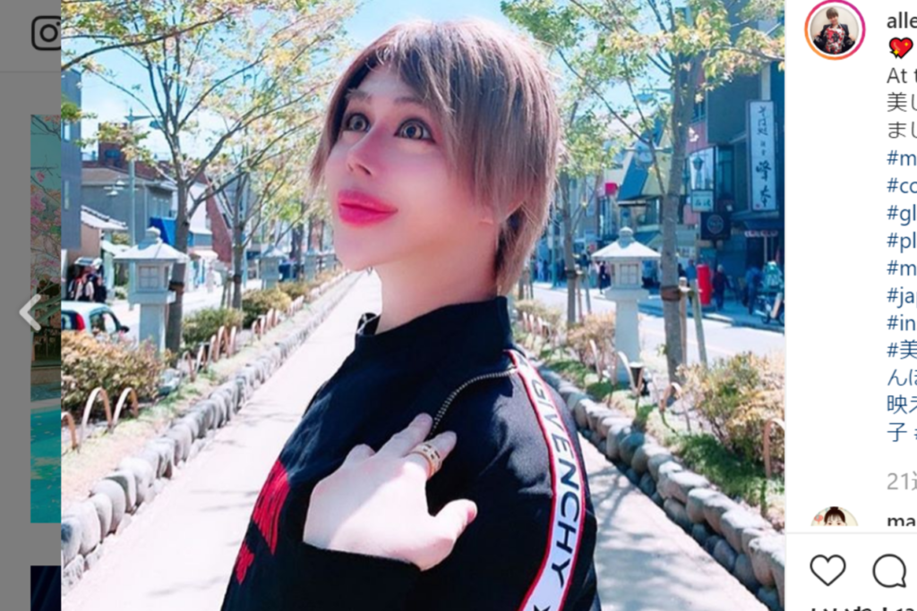 整形男子アレンはどんな人？本名や現在は？1億円超の整形で美の追及はなぜ？ | トレレピ