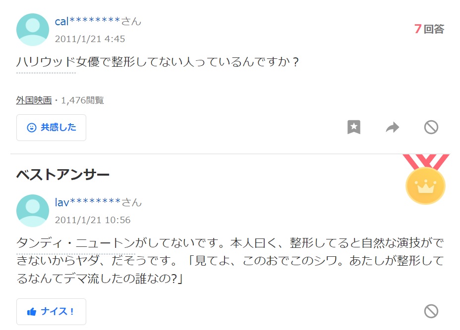 タンディウェ・ニュートンは整形をしているのか?