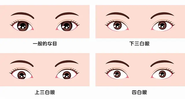 三白眼